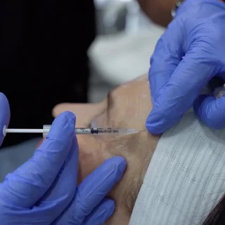 Toxina botulínica